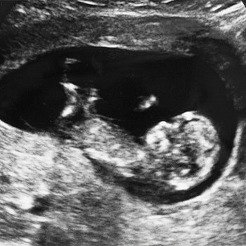 https://hakimanteb.com/wp-content/uploads/2024/07/3_months_pregnant_4.jpg
